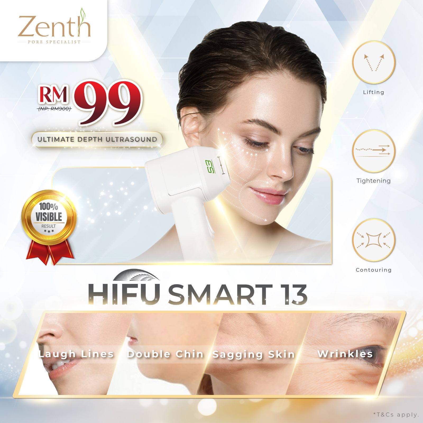 Smart HIFU 13