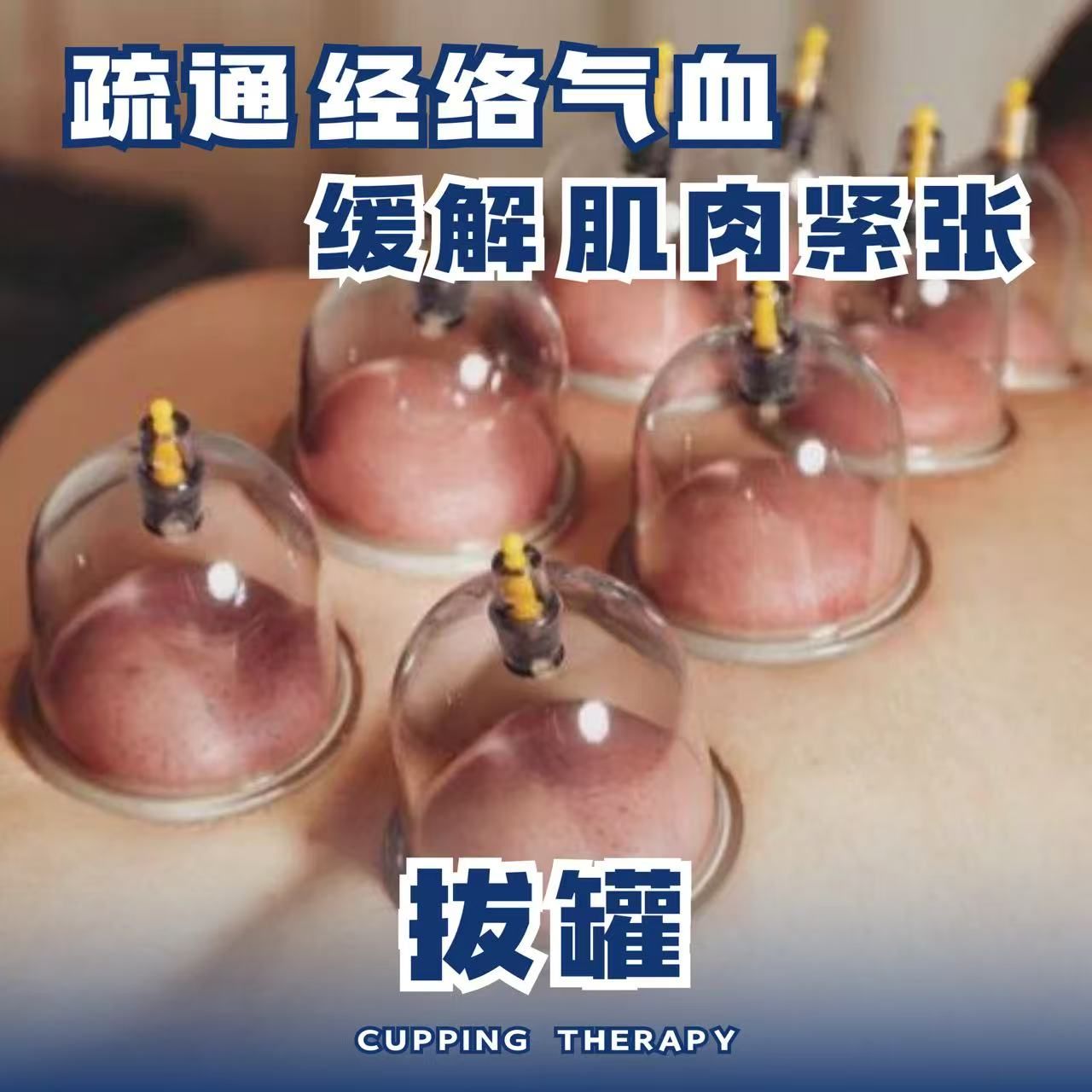 气罐 / 火罐