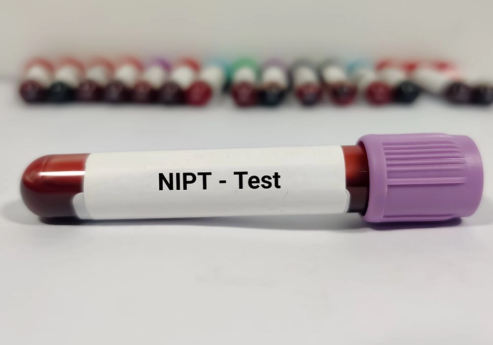 NT Scan + NIPT