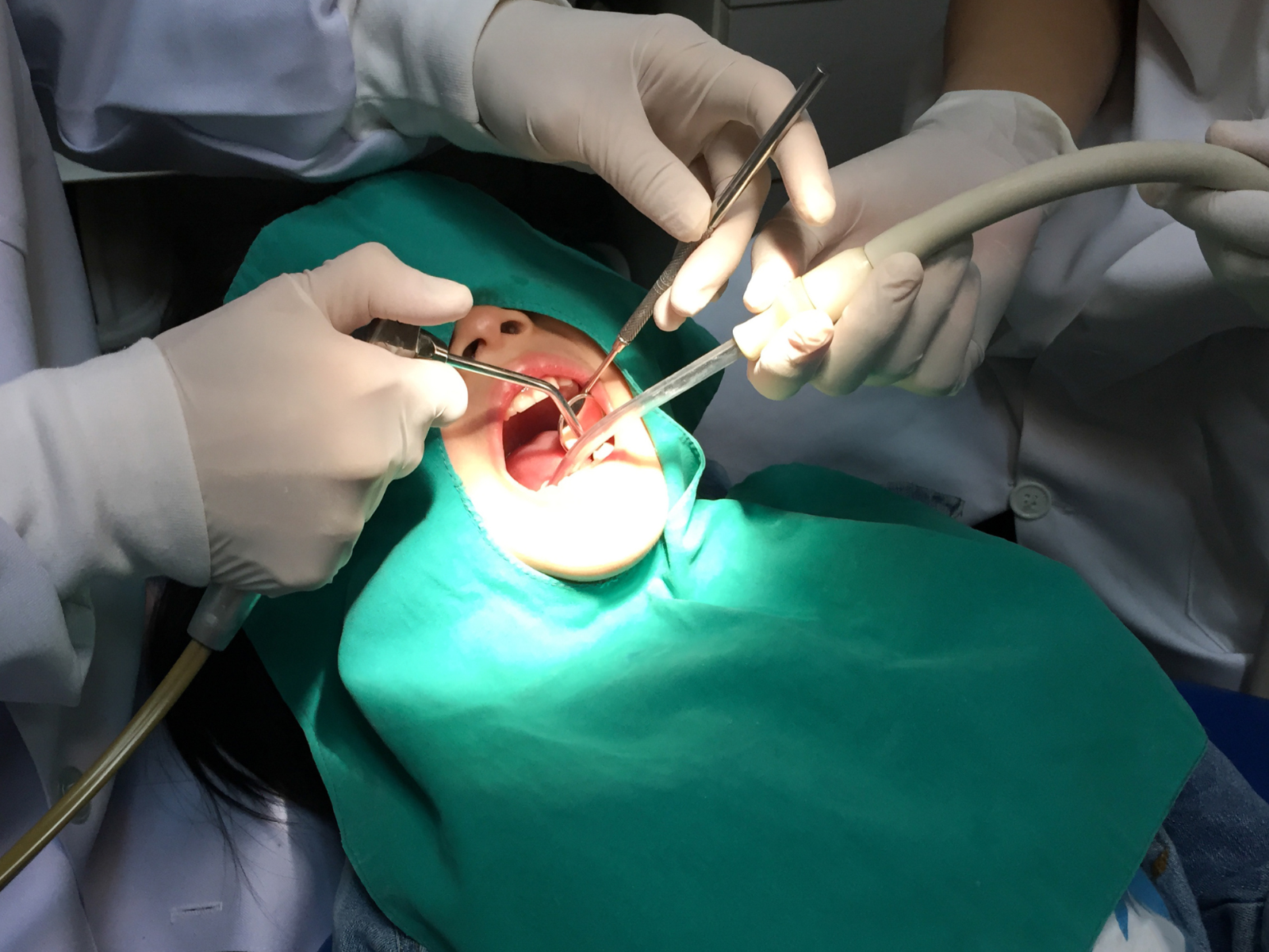 Minor Oral Surgery