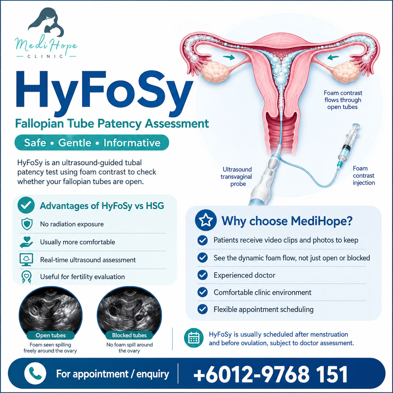 ExEm Foam HyFoSy: A Gentler, Radiation-Free Fallopian Tube Test