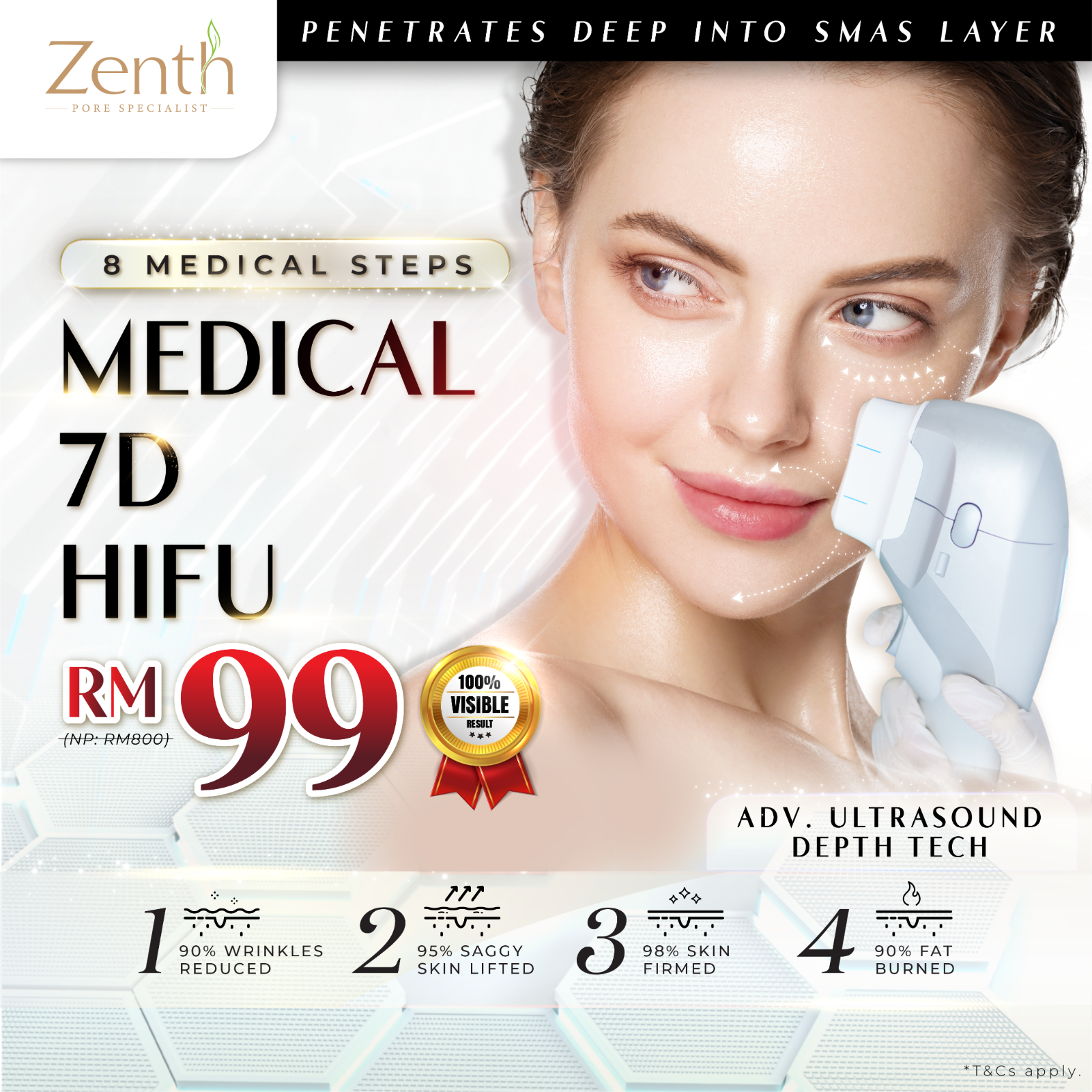 7D-HIFU Medical Skin Tightening