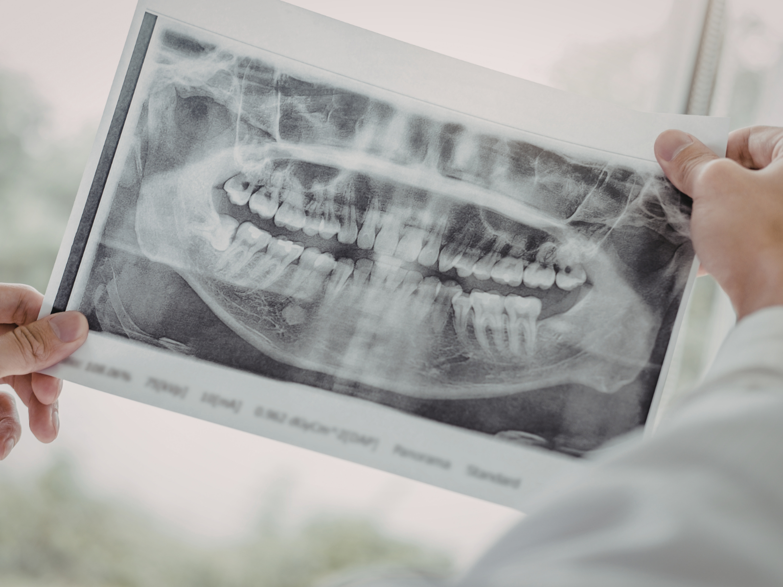 Dental X-ray