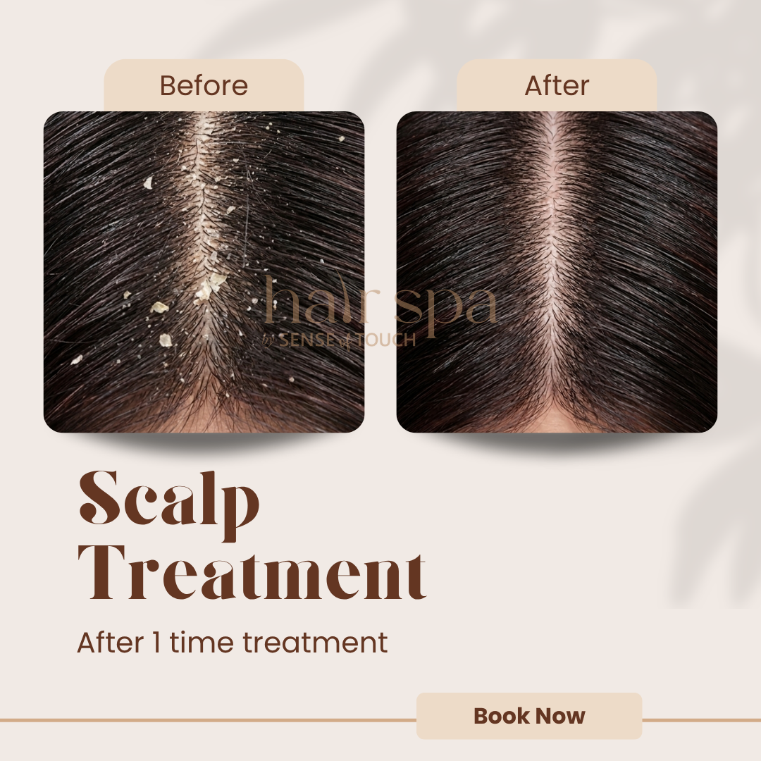 Anti-Dandruff Scalp Treatment