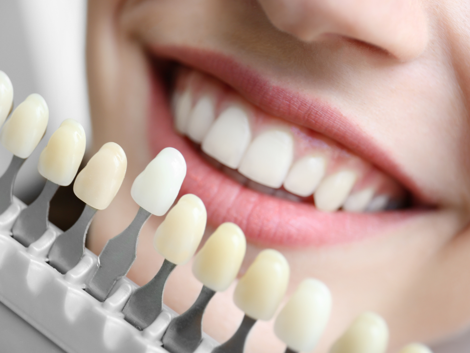 Teeth Whitening