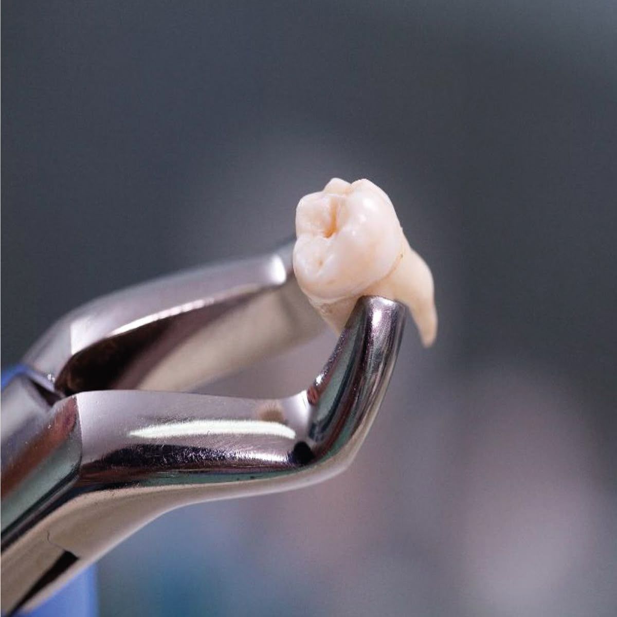 Painless Tooth Extraction Johor Bahru | Gentle Tooth Removal JB Mount Austin & Taman Pelangi