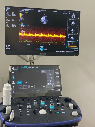 Echocardiography