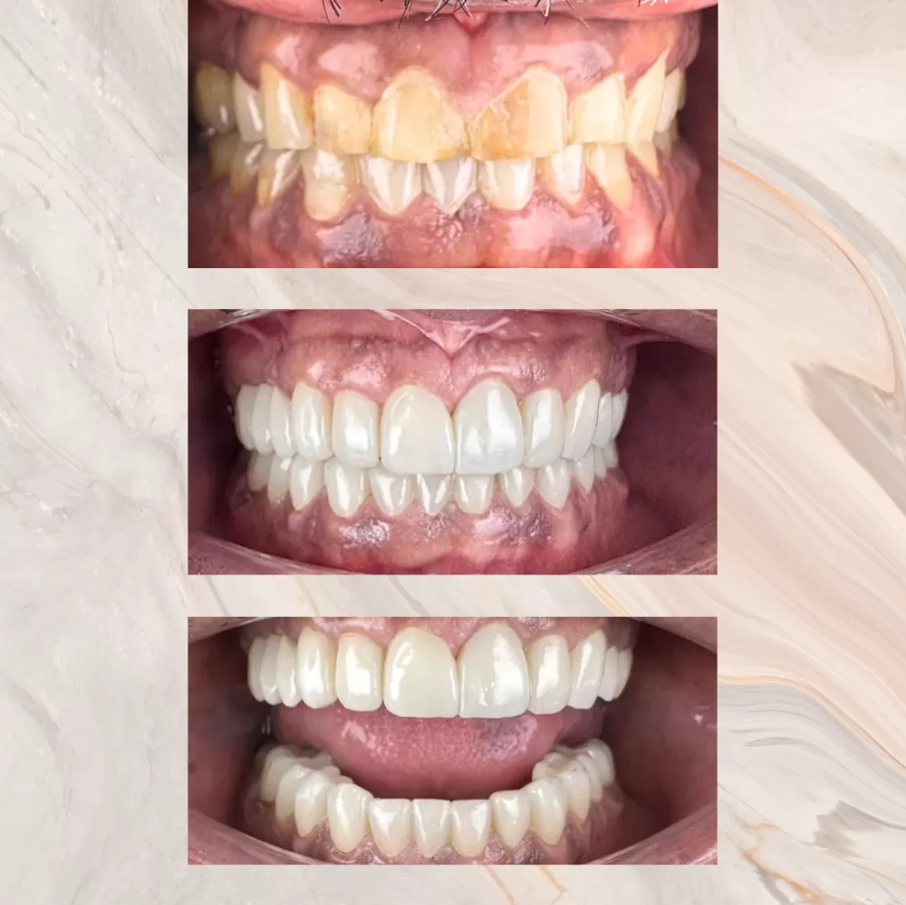 Restorative Dentistry