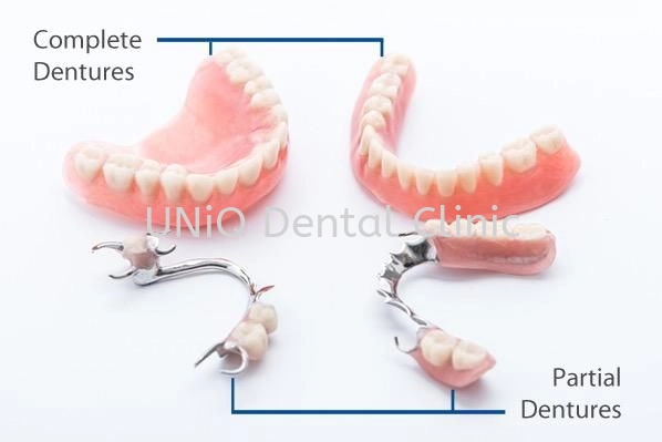 Partial Dentures