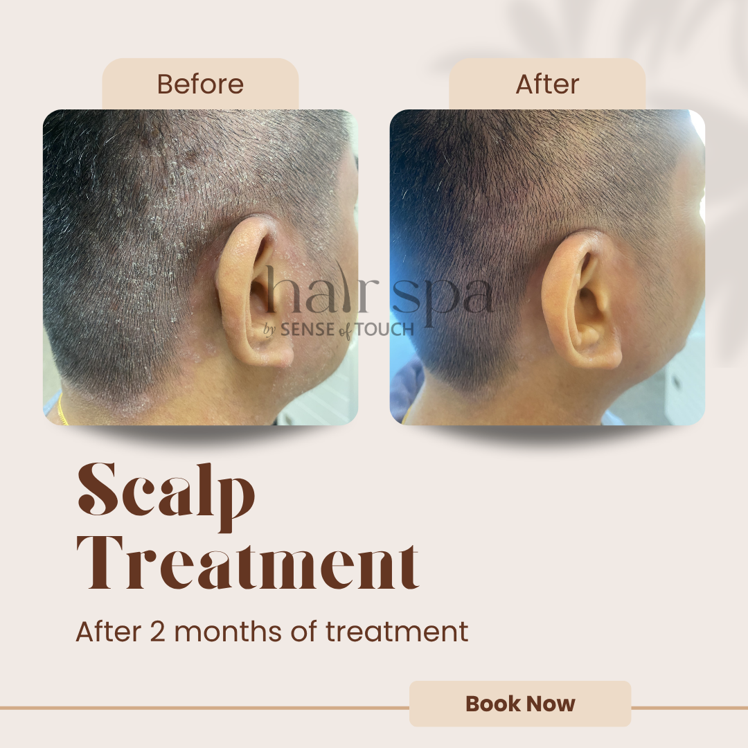 Dry/Itchy Scalp Treatment