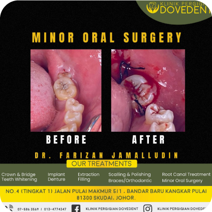 Minor Oral Surgery's Logo