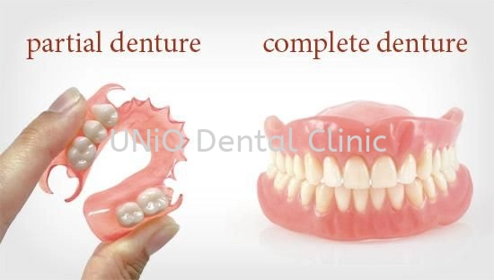 Partial Dentures