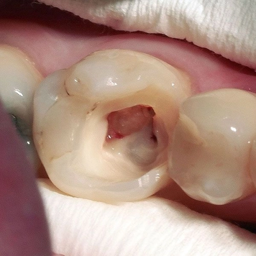 Molar