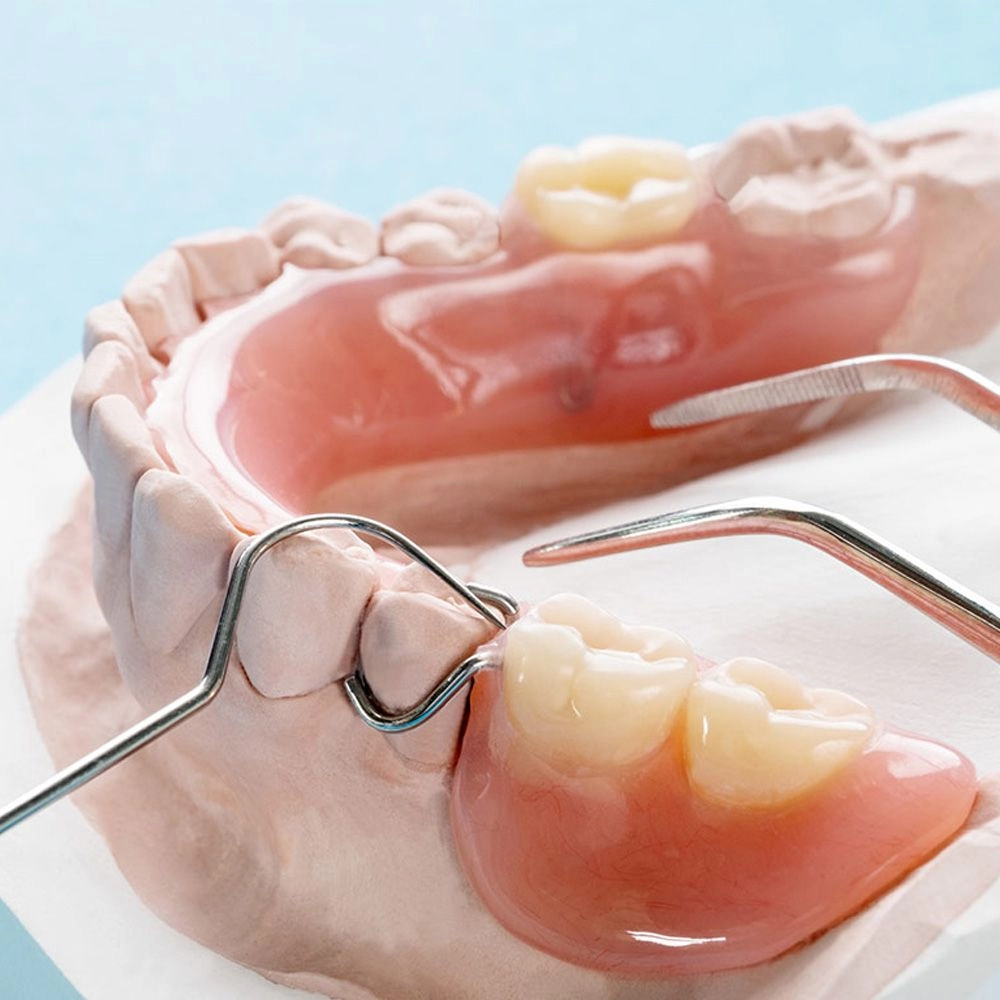 Removable Dentures / High Suction Denture