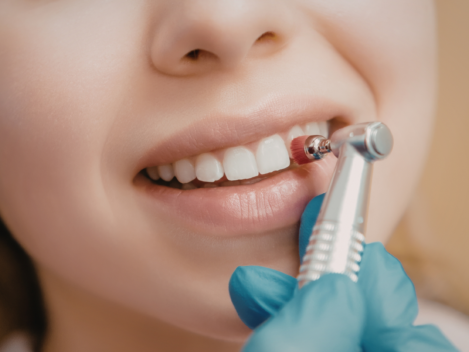 Teeth Scaling Johor Bahru | Professional Dental Cleaning JB Mount Austin & Taman Pelangi