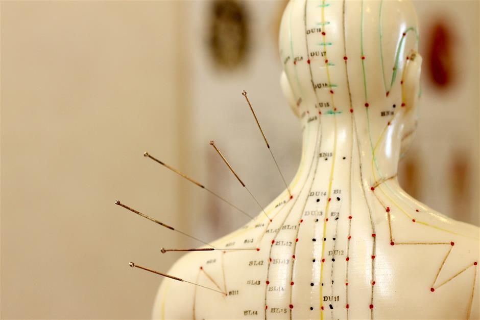 Acupuncture Treatment