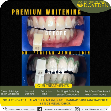 Premium Whitening's Logo