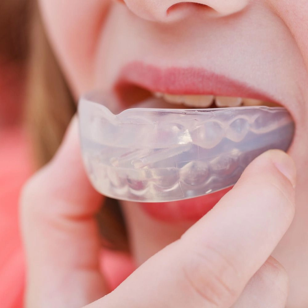 Mouth Guard