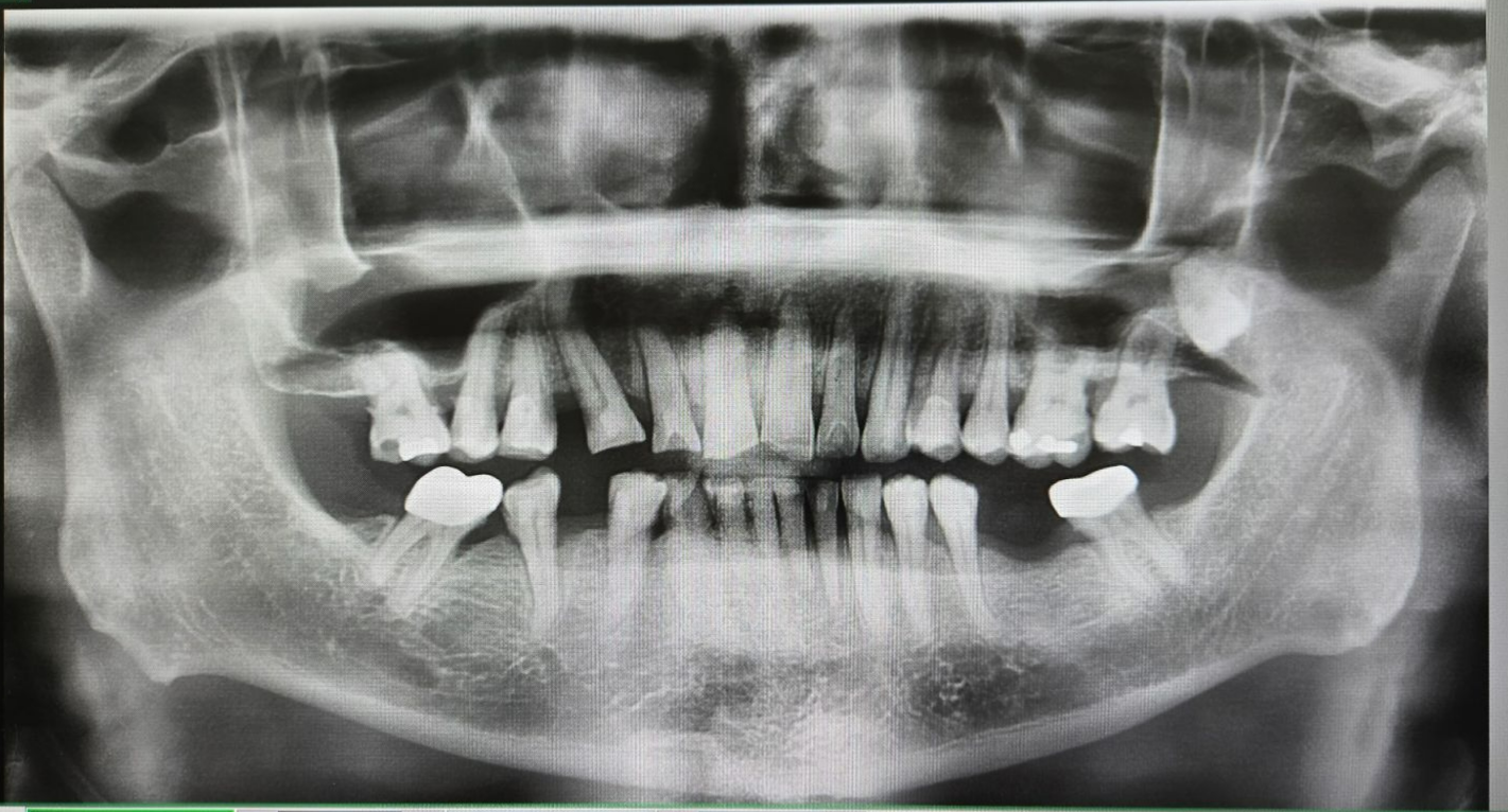 Dental X-ray Johor Bahru | Oral Scan JB Mount Austin & Taman Pelangi