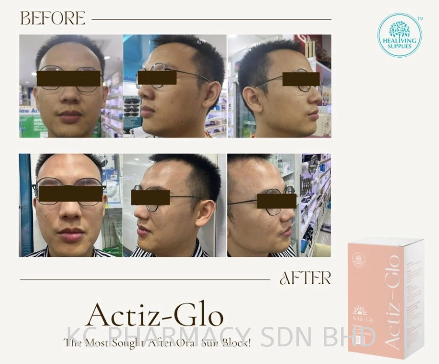 (HOT PRODUCT) ACTIZ GLO (TO PROVIDE A GOOD WHITE SKIN AND PROTECT UV)