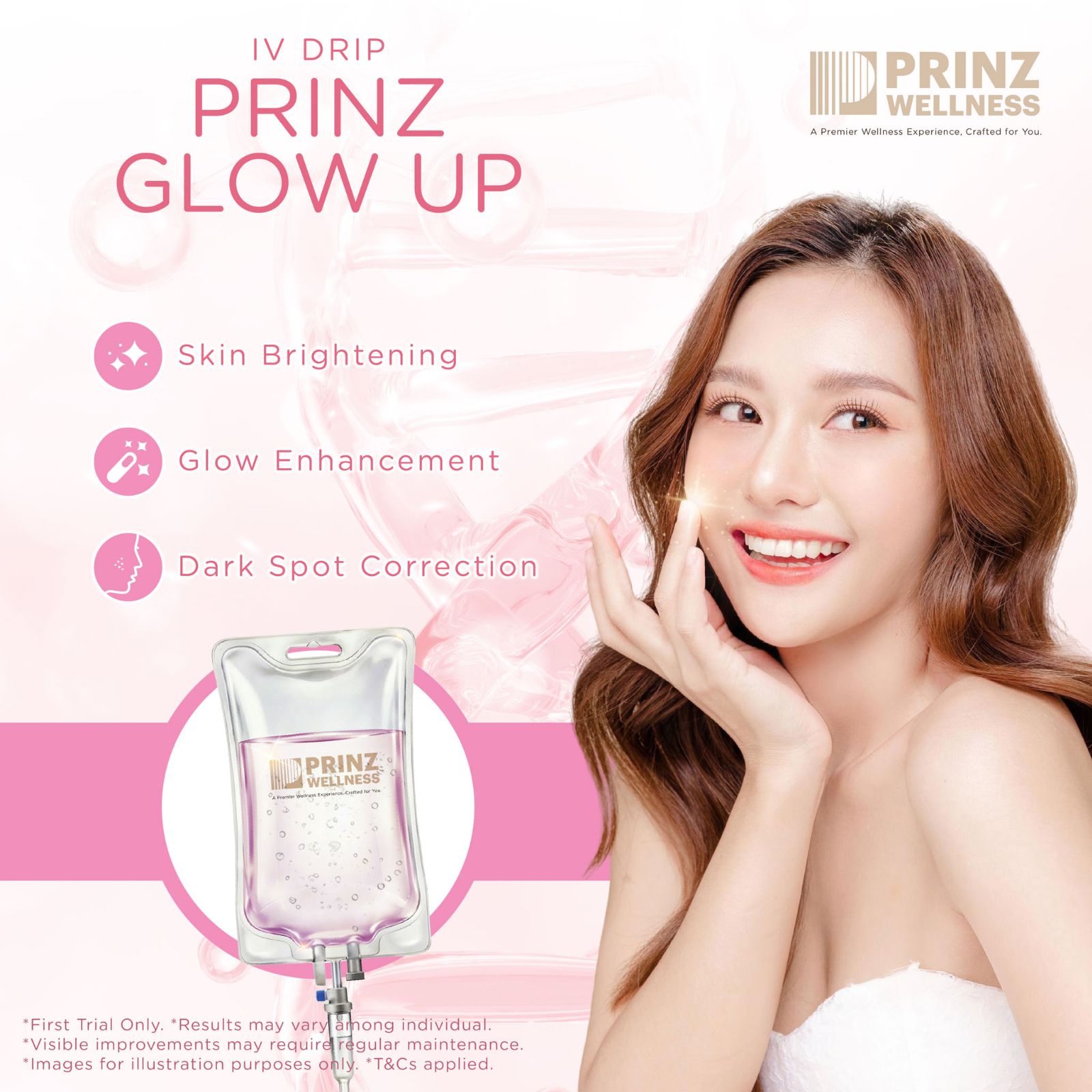 Prinz Glow Up