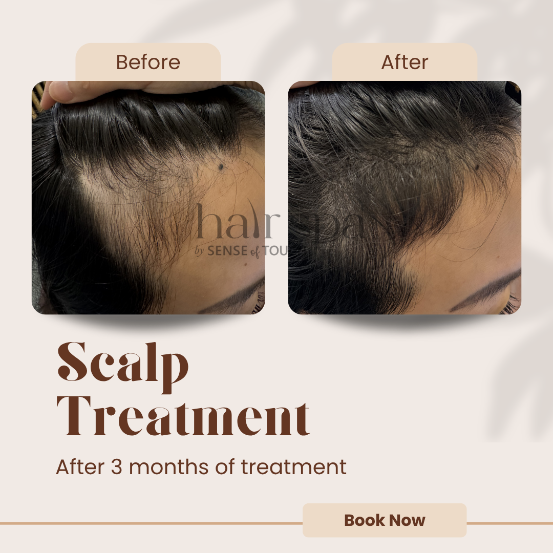 Hair Growth Scalp Treatment