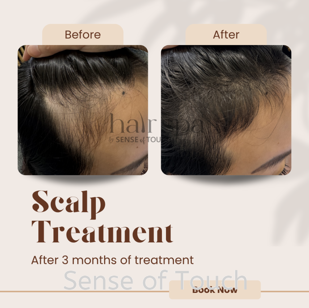 Hair Growth Scalp Treatment