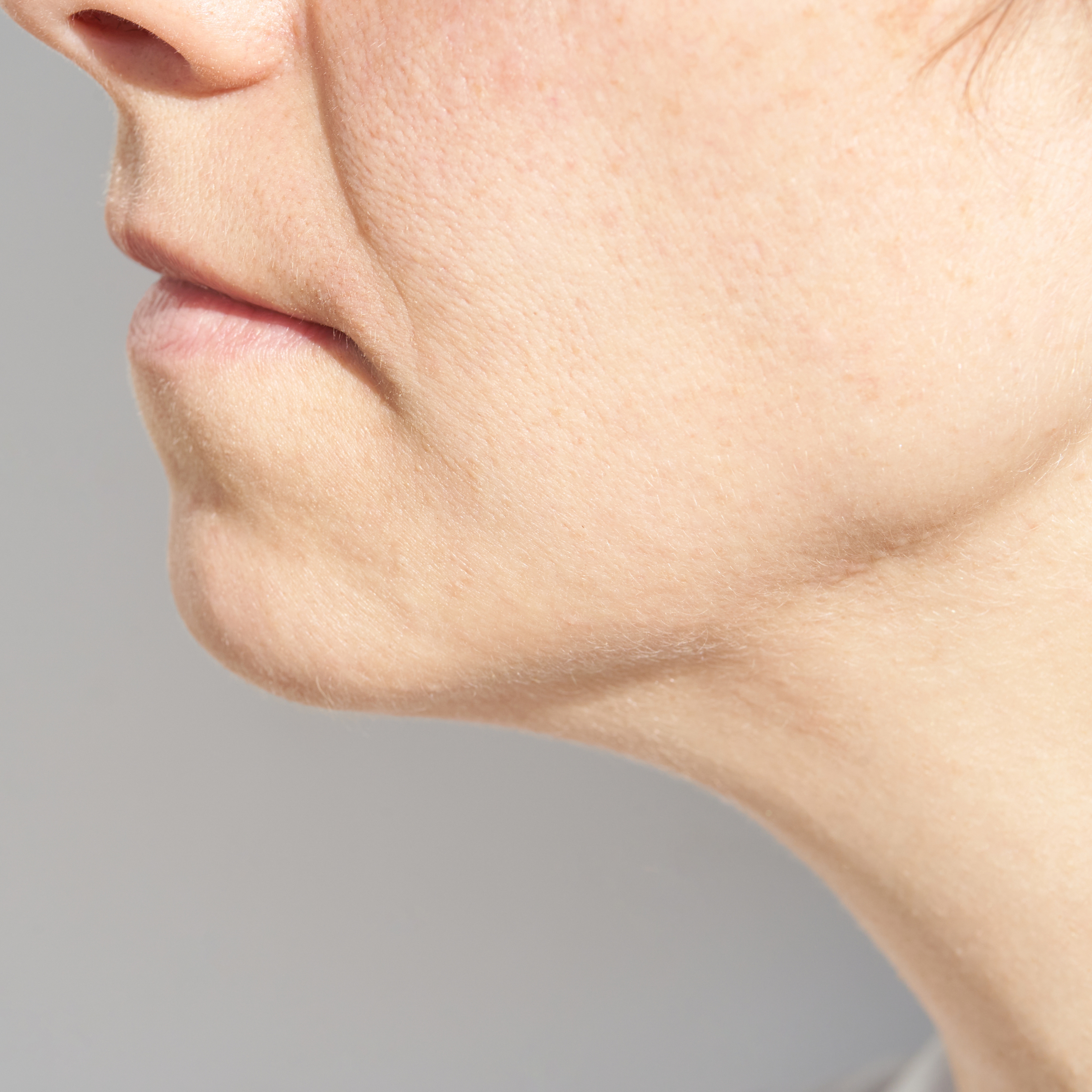 Blurred jawline contours - Dr Wee Clinic