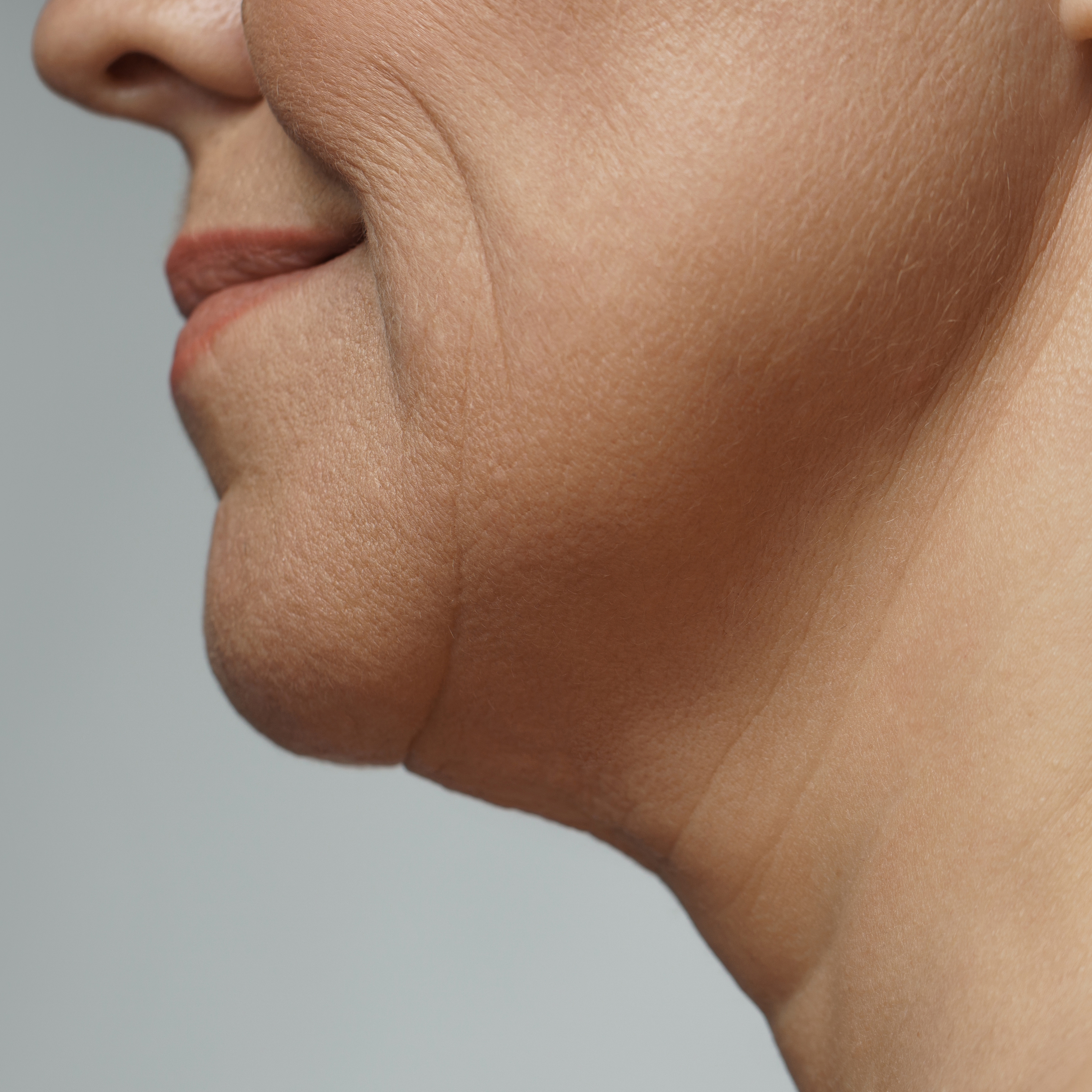 Mandibular border blurring - Dr Wee Clinic