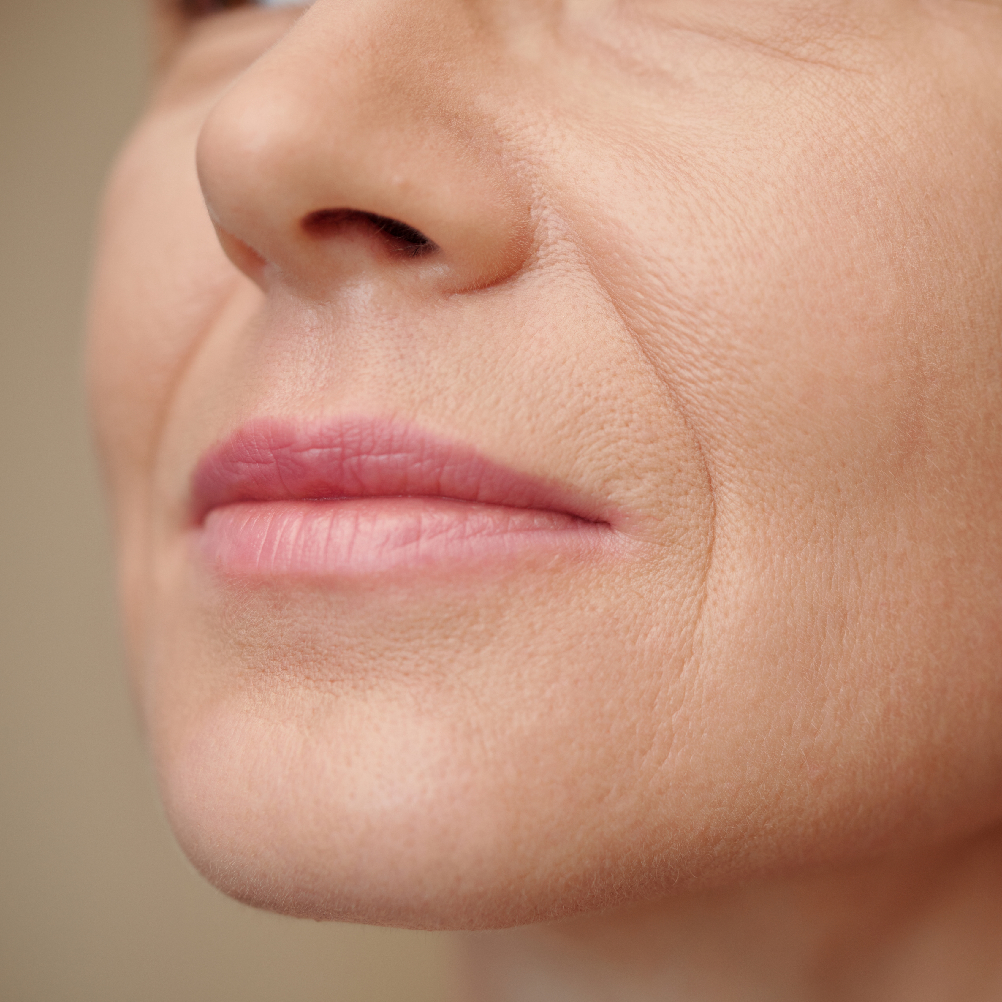 Deepening nasolabial folds - Dr Wee Clinic